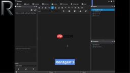 Rontgen AI 音频转录终极指南：自定义AI工作流程