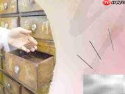 针灸注意事项全解析