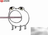 肝硬化合并胆石症机制