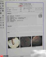 胶囊胃镜使用指南