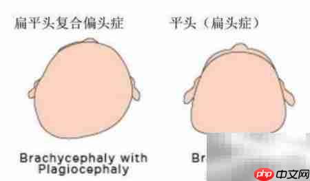 宝宝头型定型时间揭秘