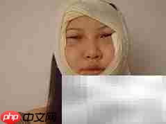 整容:美丽还是风险?