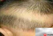 宝贝缺钙的5大症状