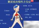 糖尿病饮食调理全攻略