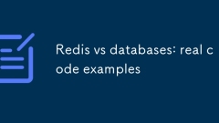Redis vs ?????? : ?? ?? ??