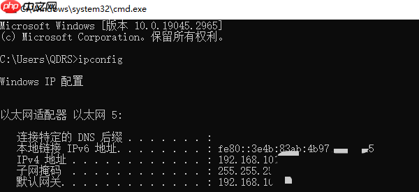 电脑ip地址在哪里查看 详细教程