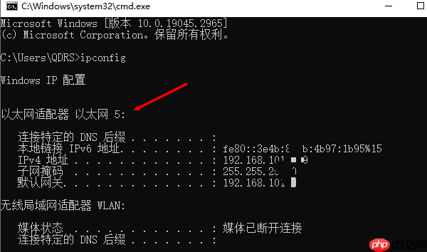 电脑本地连接在哪里找 电脑没有本地连接解决方法