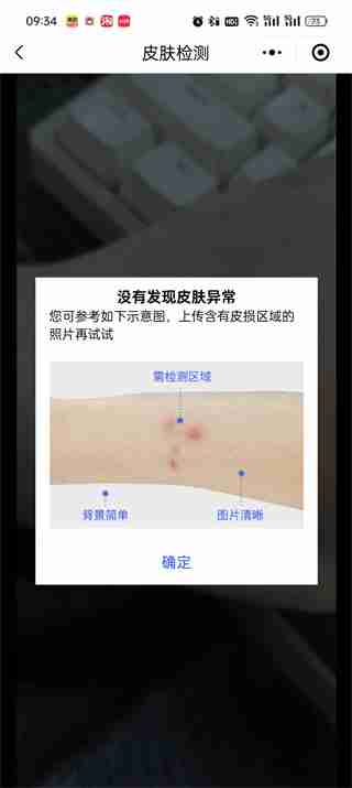 微信怎么扫一扫识别皮肤病 微信扫一扫识别皮肤病操作一览