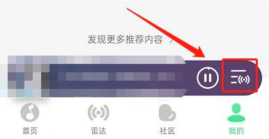 QQ音乐如何关闭雷达模式 QQ音乐关闭雷达模式教程