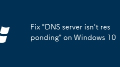 Fix 'DNS server isn't responding' on Windows 10