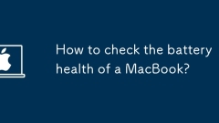 How to check the battery health of a MacBook?