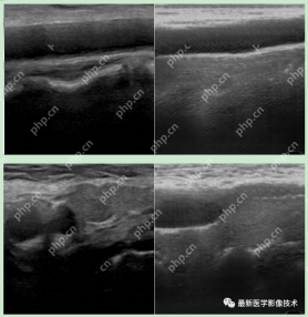 USenhance2023——2023 年超声图像增强挑战赛