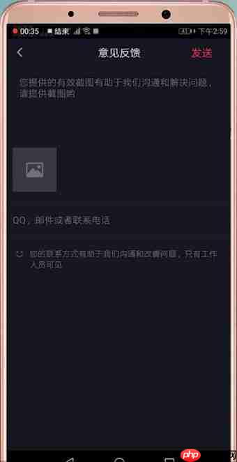 在抖音里怎么联系客服？联系客服的方法说明