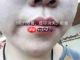 wink怎么快速美白
