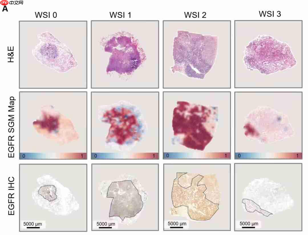 准确率高达 99%！腾讯 AI 可预测肺癌基因突变