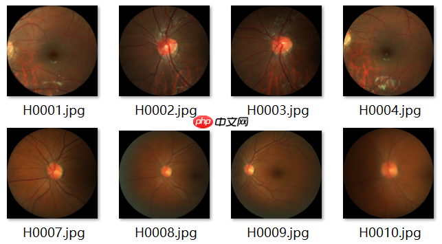 ResNet及BCD版本详解且在眼疾识别中应用实例 - php中文网