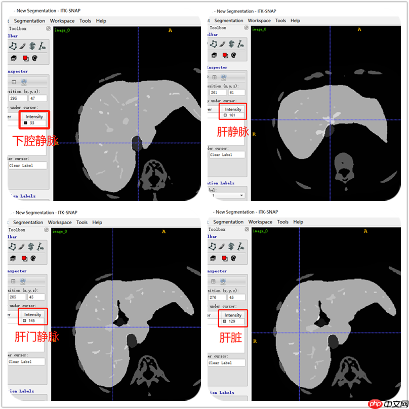 CT影像数据DICOM与图像分割(paddle2.0) - php中文网