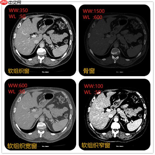 CT影像数据DICOM与图像分割(paddle2.0) - php中文网