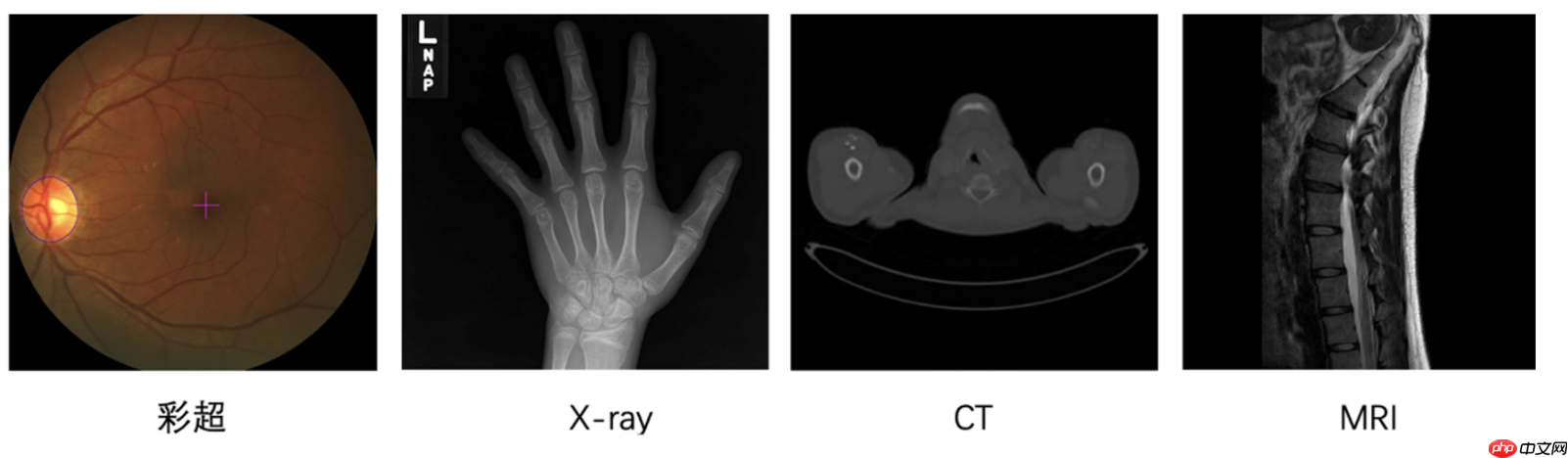 “中国软件杯”大学生软件设计大赛-3D智慧医疗baseline - php中文网