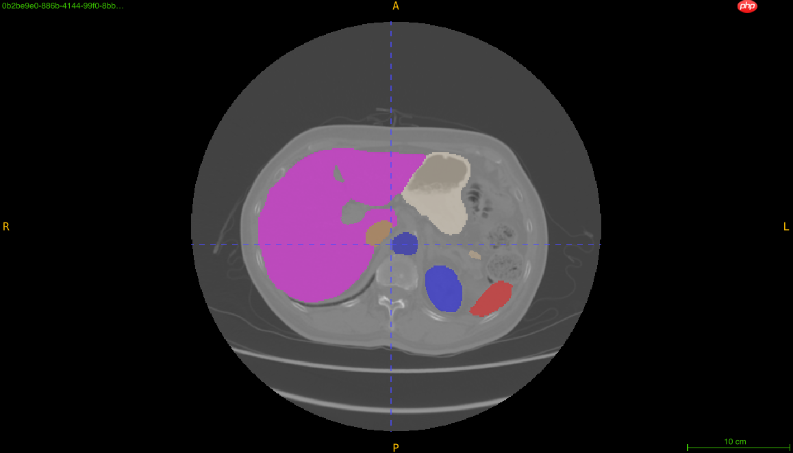 “中国软件杯”大学生软件设计大赛-3D智慧医疗baseline - php中文网