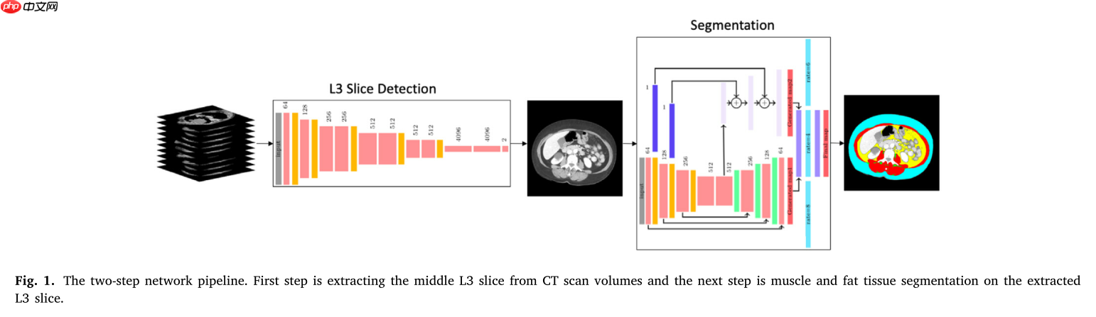『医学影像』基于Unet+++实现脊柱MRI定位（上） - php中文网