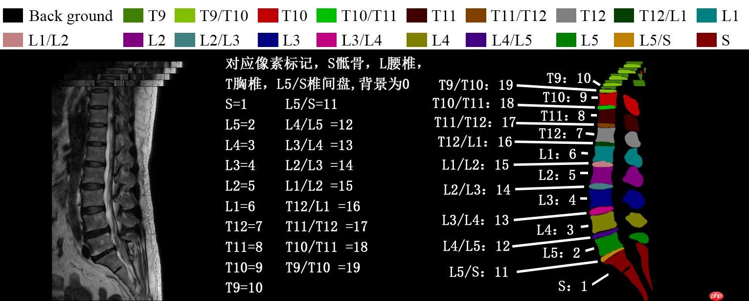 『医学影像』基于Unet+++实现脊柱MRI定位（上） - php中文网