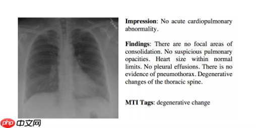 『IMAGE-CAPTION』基于CNN-RNN的影像报告生成-PRE - php中文网