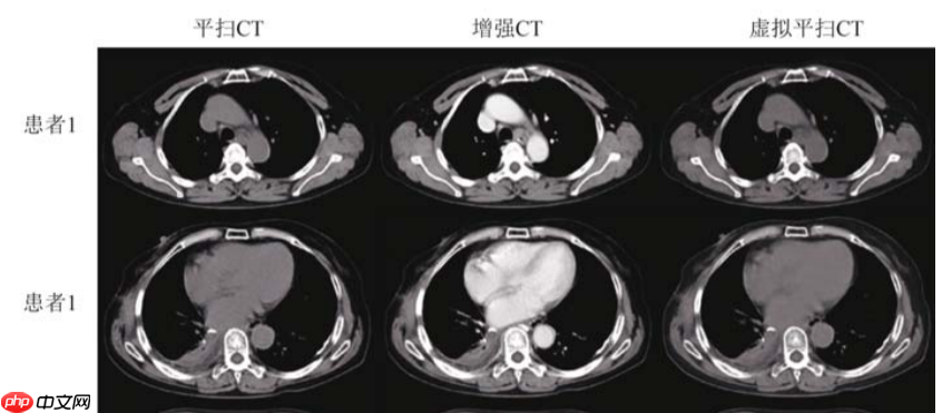 基于分割网络Unet生成虚拟图像 - php中文网