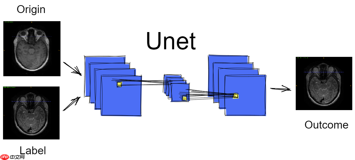 基于分割网络Unet生成虚拟图像 - php中文网