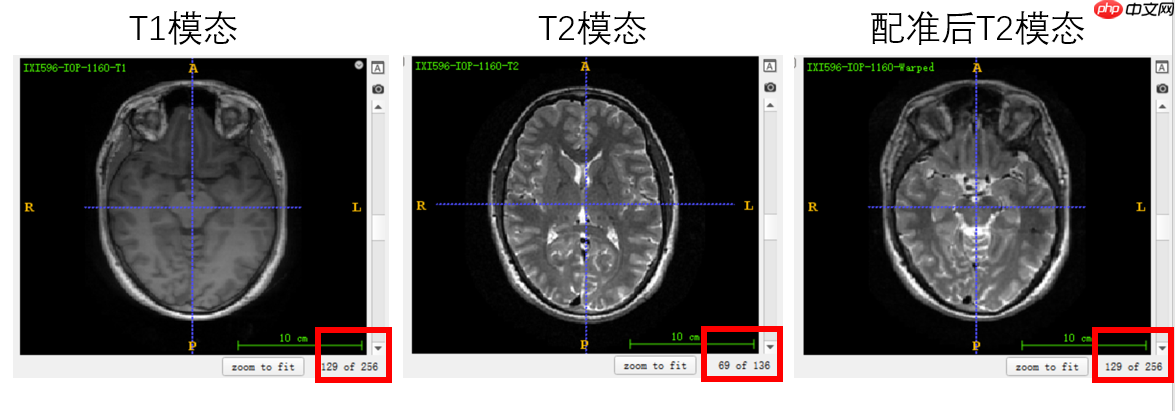 基于分割网络Unet生成虚拟图像 - php中文网
