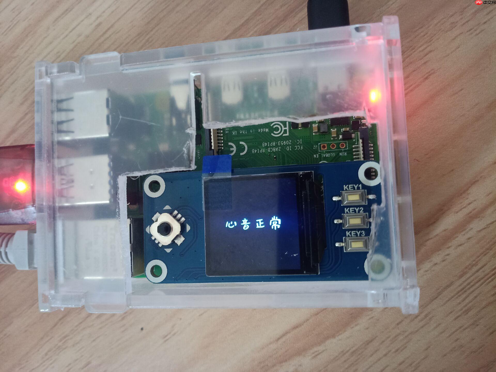 心音智能检测 - php中文网