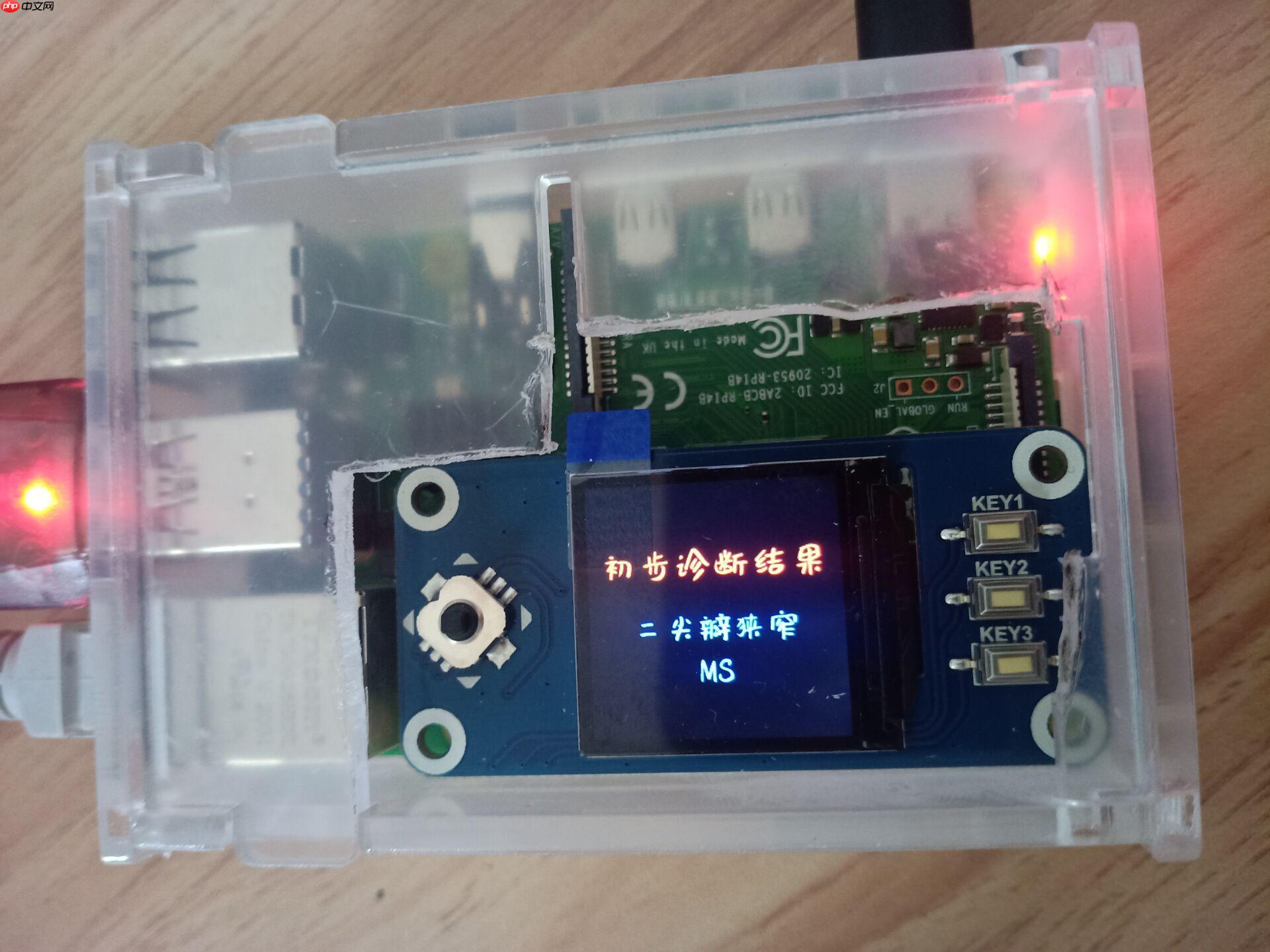 心音智能检测 - php中文网