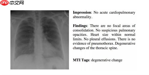 『IMAGE-CAPTION』基于CNN-RNN的影像报告生成-Ⅰ - php中文网