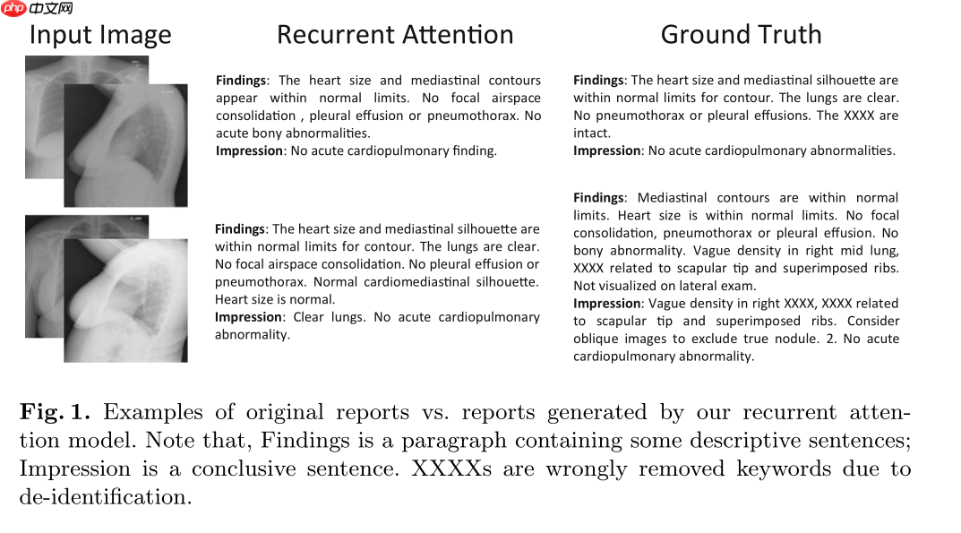 『IMAGE-CAPTION』基于CNN-RNN的影像报告生成-Ⅰ - php中文网