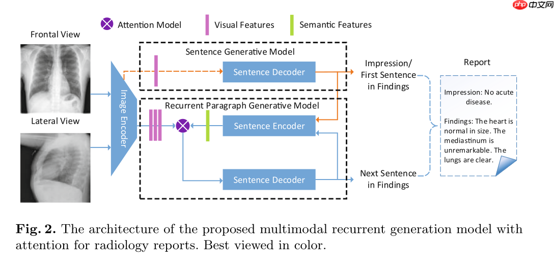 『IMAGE-CAPTION』基于CNN-RNN的影像报告生成-Ⅰ - php中文网