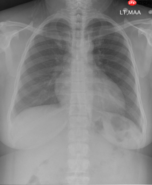 『IMAGE-CAPTION』基于CNN-RNN的影像报告生成-Ⅰ - php中文网