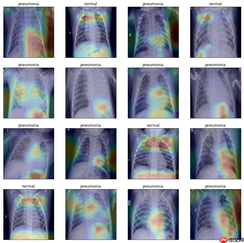基于PaddlePaddle搭建儿童X光胸部肺炎分类项目 - php中文网