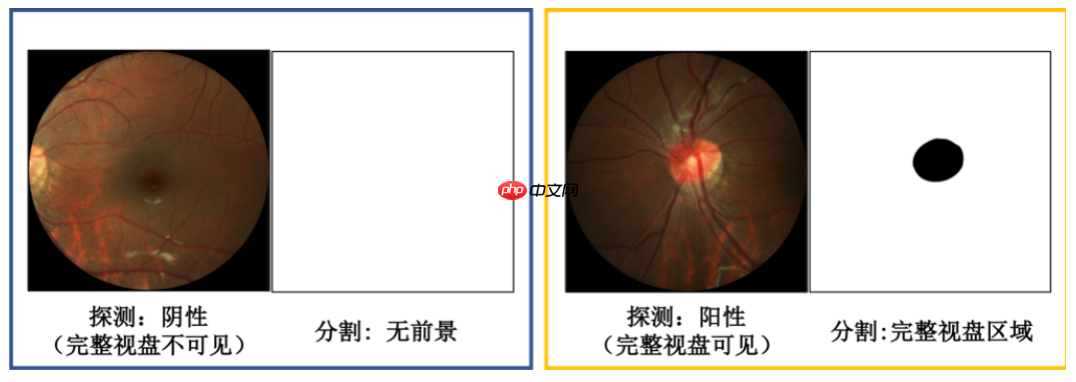 飞桨常规赛：PALM眼底彩照视盘探测与分割 2021 5月第1名方案 - php中文网