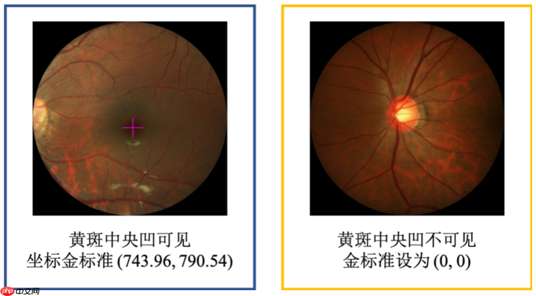 飞桨常规赛：PALM眼底彩照中黄斑中央凹定位-11月第1名方案 - php中文网