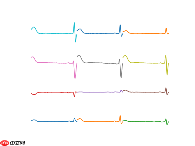 2021AIWIN-心电图智能诊断竞赛任务一Baseline - php中文网