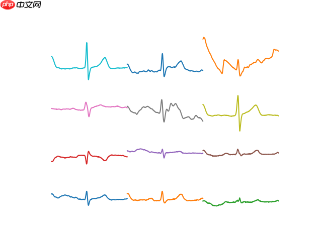 2021AIWIN-心电图智能诊断竞赛任务一Baseline - php中文网