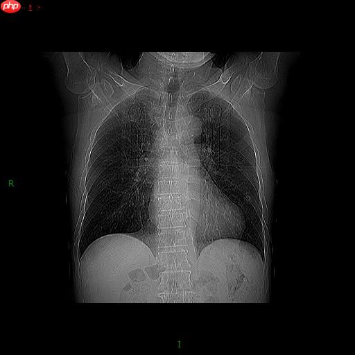 图像分割预处理简单实用技巧 - php中文网