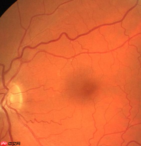 图像分割预处理简单实用技巧 - php中文网