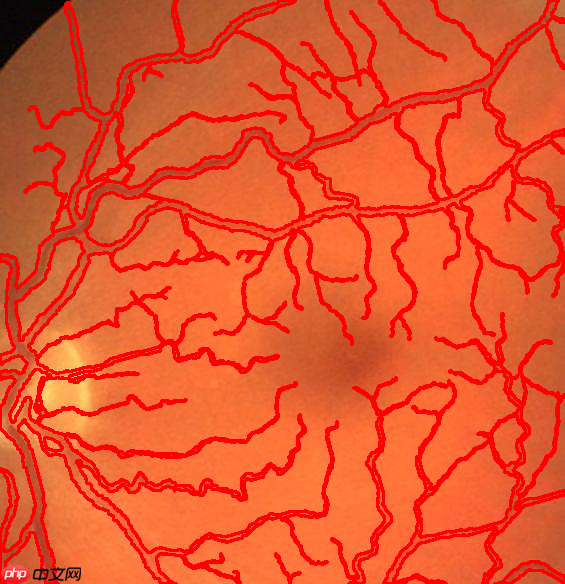 图像分割预处理简单实用技巧 - php中文网