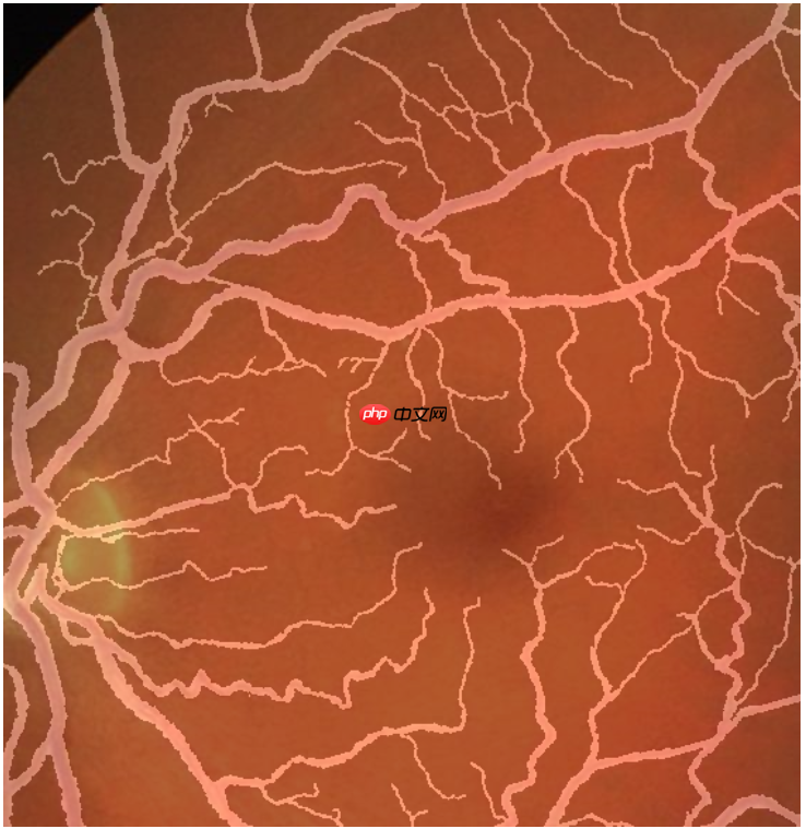 图像分割预处理简单实用技巧 - php中文网