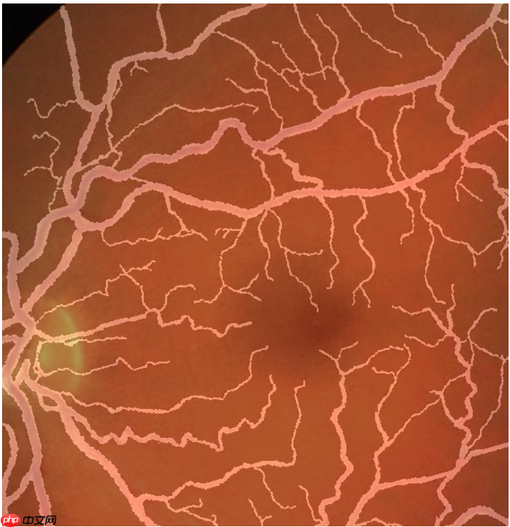 图像分割预处理简单实用技巧 - php中文网