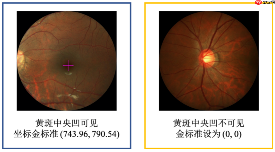 飞桨常规赛：PALM眼底彩照中黄斑中央凹定位-7月第3名方案 - php中文网