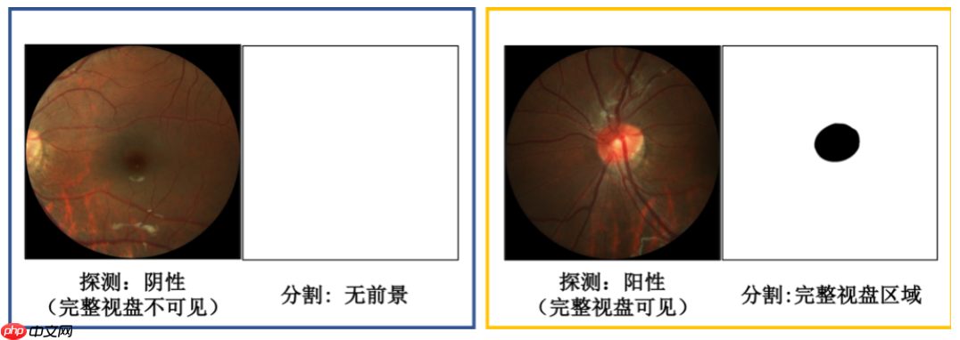 飞桨常规赛：PALM眼底彩照视盘探测与分割 - 8月第2名方案 - php中文网