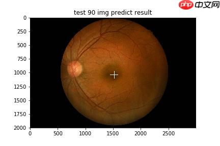 【飞桨常规赛】GAMMA中央凹检测 11月第2名方案 - php中文网