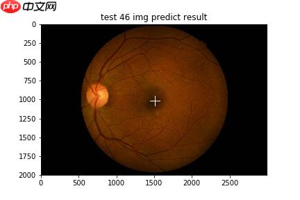 【飞桨常规赛】GAMMA中央凹检测 11月第2名方案 - php中文网